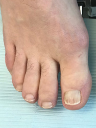 improved nail