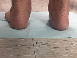 photos posterior