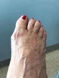 toenail finished