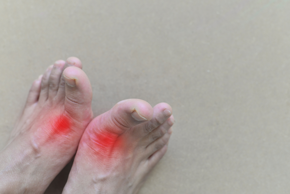 gout