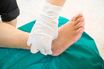 Diabetic Ulcers Treatment in the Niagara Falls, St. Catharines, Welland, Port Colborne, Fort Erie, Thorold, Niagara-on-the-Lake, ON areas