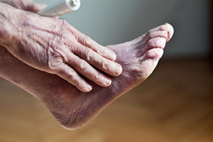 Poor Blood Circulation and the Feet