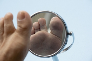Poor Wound Healing and Diabetes