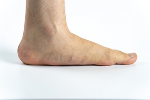 Tips for Managing Flat Feet