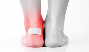 Taking Care of Foot Blisters