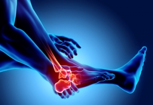 Several Kinds of Arthritis