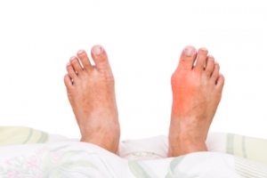 Reasons Bunions Can Develop