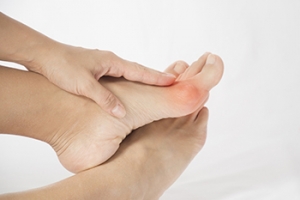 The Difference Between Bunions and Gout